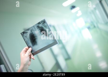 Röntgenbild`s Patienten in der Hand des Menschen. Stockfoto